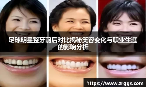 足球明星整牙前后对比揭秘笑容变化与职业生涯的影响分析